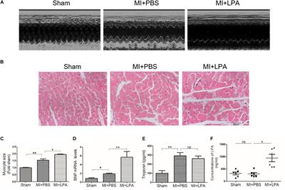 Lysophosphatidic Acid Is Associated With Cardiac Dysfunction and Hypertrophy by Suppressing Autophagy via the LPA3/AKT/mTOR Pathway